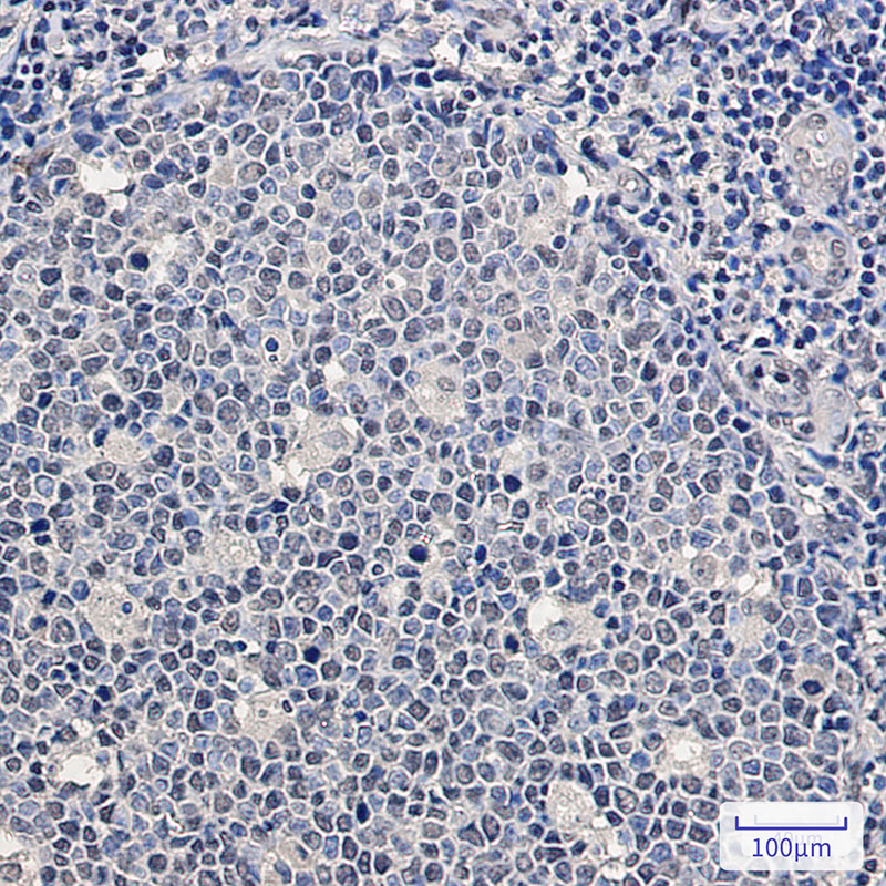 IHC - SF2 Rabbit mAb AP76073